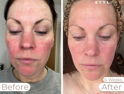 LED Professional Bundle