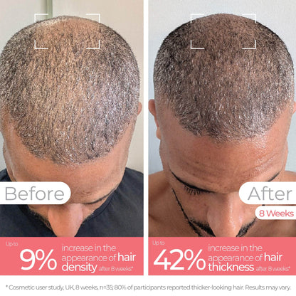 LED Professional Bundle